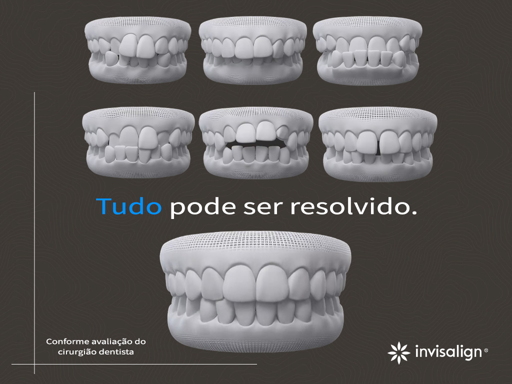 A ciência por trás do Invisalign Santini Odontologia