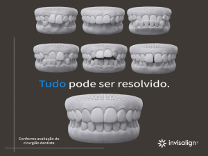 Invisalign Brasil - O tratamento com os alinhadores Invisalign® acabou, mas  manter o sorriso alinhado com discrição e transparência ainda pode fazer  parte da sua rotina. Como parte da resposta biológica do