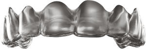 Invisalign - Ortodontia